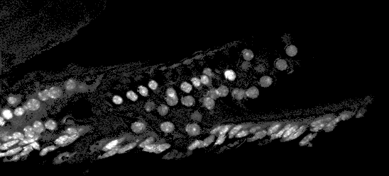 One channel of a fluorescence Z-stack flattened into one all-in-focus image, shown in greyscale